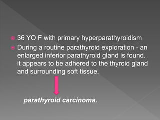  36 YO F with primary hyperparathyroidism
 During a routine parathyroid exploration - an
enlarged inferior parathyroid gland is found.
it appears to be adhered to the thyroid gland
and surrounding soft tissue.
parathyroid carcinoma.
 