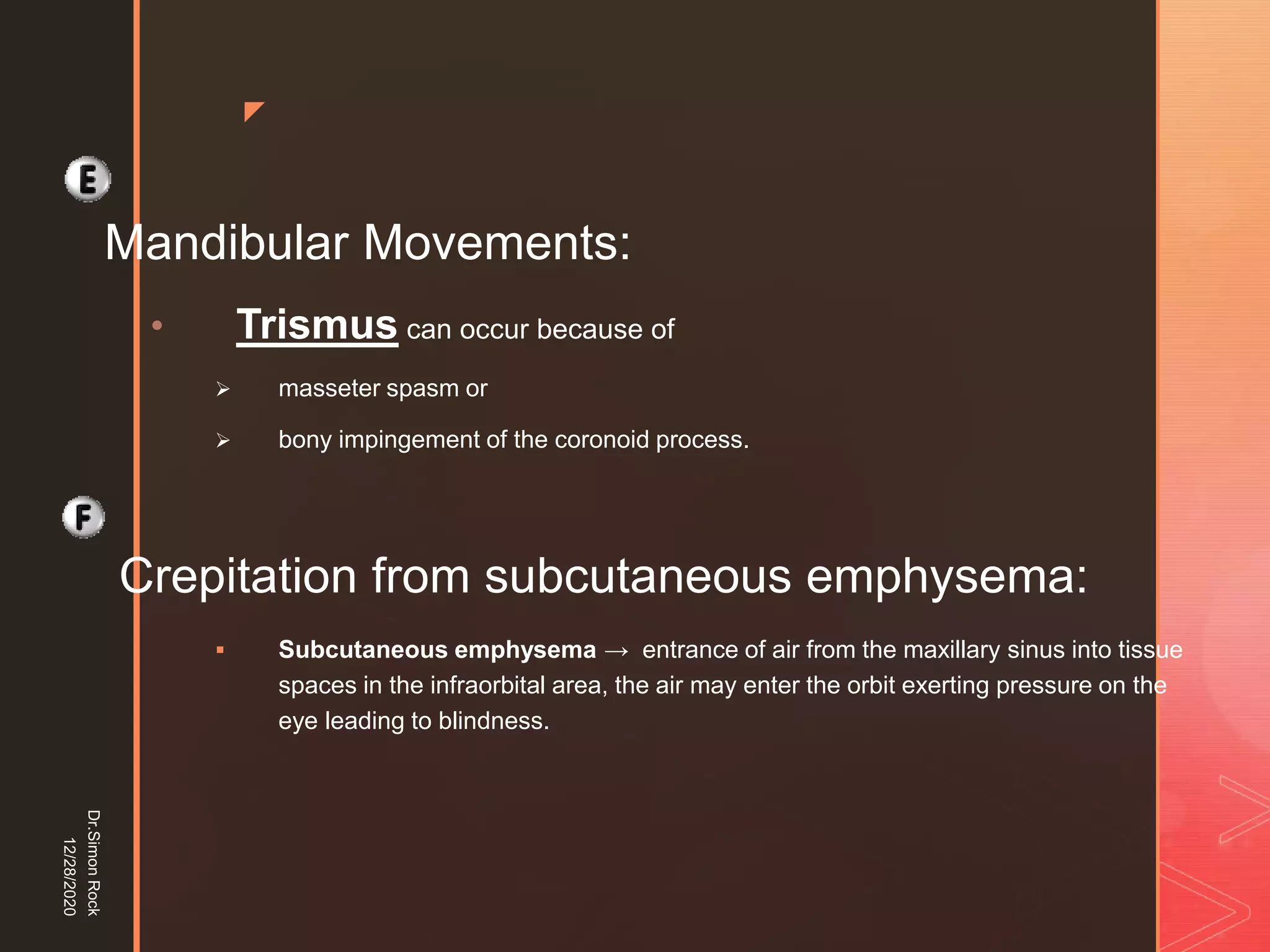 5. zygomatic fracture