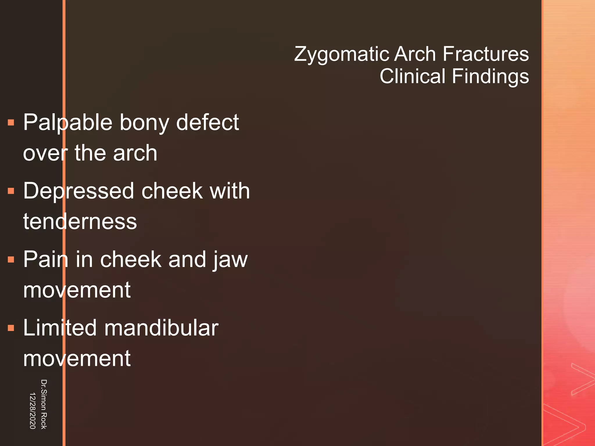 5. zygomatic fracture