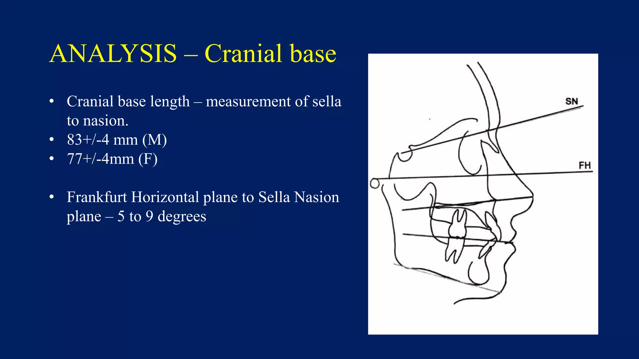 ANALYSIS – Cranial base
• Cranial base length – measurement of sella
to nasion.
• 83+/-4 mm (M)
• 77+/-4mm (F)
• Frankfurt Horizontal plane to Sella Nasion
plane – 5 to 9 degrees
 
