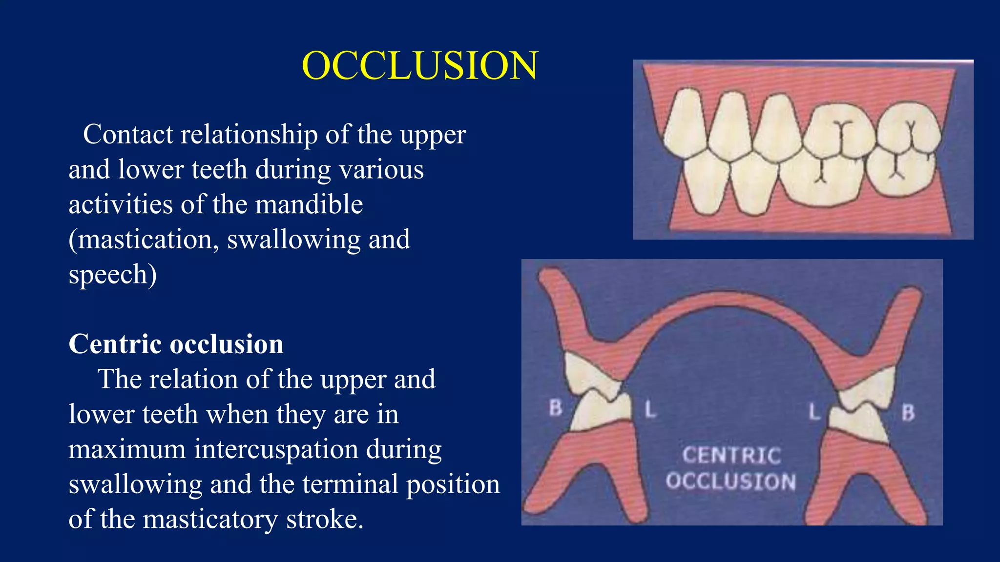 OCCLUSION
Contact relationship of the upper
and lower teeth during various
activities of the mandible
(mastication, swallowing and
speech)
Centric occlusion
The relation of the upper and
lower teeth when they are in
maximum intercuspation during
swallowing and the terminal position
of the masticatory stroke.
 