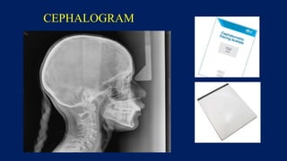 Cephalometry and occlusion of teeth | PPTX