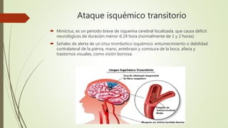 Ataque isquémico transitorio
 Miniictus, es un periodo breve de isquemia cerebral localizada, que causa déficit
neurológicos de duración menor d 24 hora (normalmente de 1 y 2 horas).
 Señales de alerta de un ictus trombotico isquémico: entumecimiento o debilidad
contralateral de la pierna, mano, antebrazo y comisura de la boca, afasia y
trastornos visuales, como visión borrosa.
 