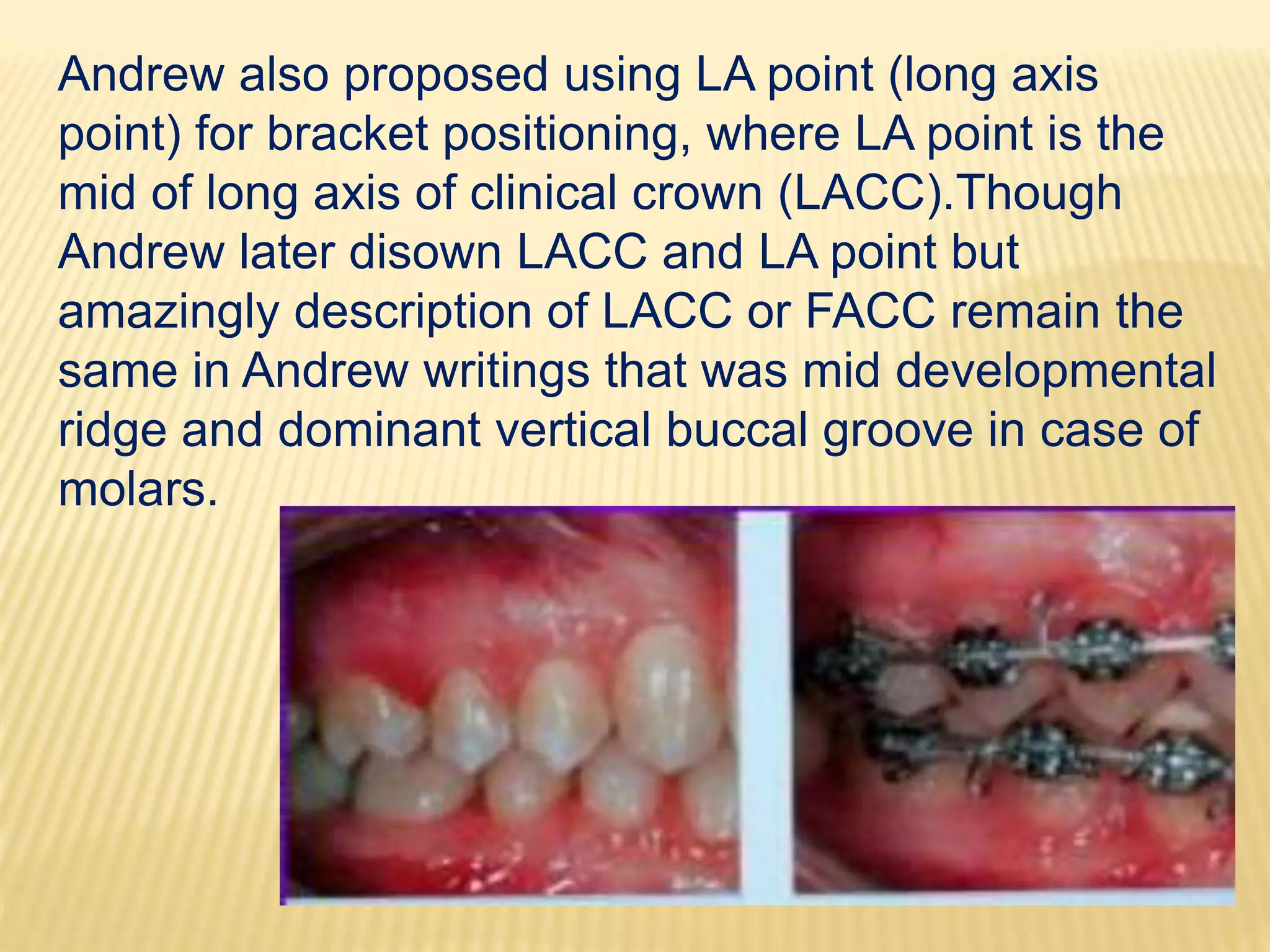 BRACKET PLACEMENT IN ORTHODONTIC BONDING | PPTX