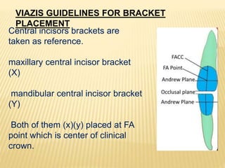 Central incisors brackets are
taken as reference.
maxillary central incisor bracket
(X)
mandibular central incisor bracket
(Y)
Both of them (x)(y) placed at FA
point which is center of clinical
crown.
VIAZIS GUIDELINES FOR BRACKET
PLACEMENT
 
