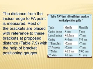 The distance from the
incisor edge to FA point
is measured. Rest of
the brackets are placed
with reference to these
brackets at proposed
distance (Table 7.9) with
the help of bracket
positioning gauges
 