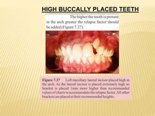 HIGH BUCCALLY PLACED TEETH
 