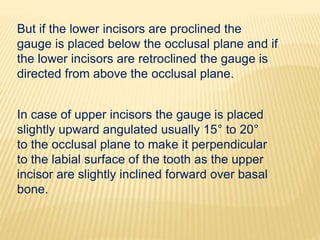 In case of upper incisors the gauge is placed
slightly upward angulated usually 15° to 20°
to the occlusal plane to make it perpendicular
to the labial surface of the tooth as the upper
incisor are slightly inclined forward over basal
bone.
But if the lower incisors are proclined the
gauge is placed below the occlusal plane and if
the lower incisors are retroclined the gauge is
directed from above the occlusal plane.
 