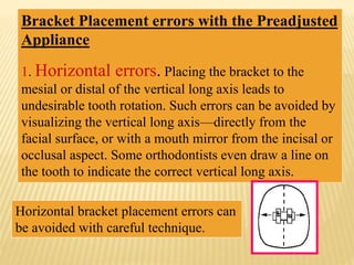Bracket Placement errors with the Preadjusted
Appliance
1. Horizontal errors. Placing the bracket to the
mesial or distal of the vertical long axis leads to
undesirable tooth rotation. Such errors can be avoided by
visualizing the vertical long axis—directly from the
facial surface, or with a mouth mirror from the incisal or
occlusal aspect. Some orthodontists even draw a line on
the tooth to indicate the correct vertical long axis.
Horizontal bracket placement errors can
be avoided with careful technique.
 