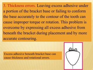 3. Thickness errors. Leaving excess adhesive under
a portion of the bracket base or failing to conform
the base accurately to the contour of the tooth can
cause improper torque or rotation. This problem is
overcome by expressing all excess adhesive from
beneath the bracket during placement and by more
accurate contouring.
Excess adhesive beneath bracket base can
cause thickness and rotational errors.
 