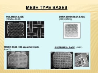 MESH TYPE BASES
 