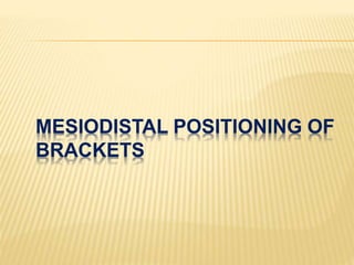 MESIODISTAL POSITIONING OF
BRACKETS
 