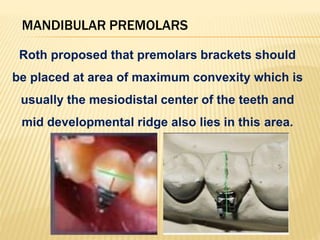 MANDIBULAR PREMOLARS
Roth proposed that premolars brackets should
be placed at area of maximum convexity which is
usually the mesiodistal center of the teeth and
mid developmental ridge also lies in this area.
 