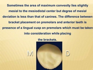 Sometimes the area of maximum convexity lies slightly
mesial to the mesiodistal center but degree of mesial
deviation is less than that of canines. The difference between
bracket placement on premolars and anterior teeth is
presence of a lingual cusp on premolars which must be taken
into consideration while placing
the brackets.
M D
 