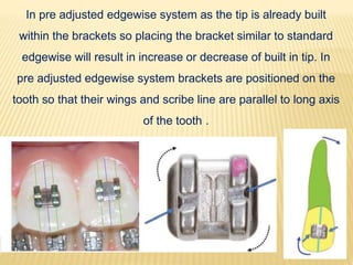 In pre adjusted edgewise system as the tip is already built
within the brackets so placing the bracket similar to standard
edgewise will result in increase or decrease of built in tip. In
pre adjusted edgewise system brackets are positioned on the
tooth so that their wings and scribe line are parallel to long axis
of the tooth .
 