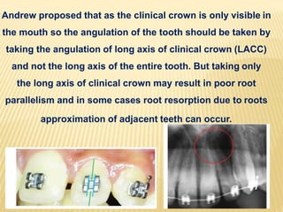 Andrew proposed that as the clinical crown is only visible in
the mouth so the angulation of the tooth should be taken by
taking the angulation of long axis of clinical crown (LACC)
and not the long axis of the entire tooth. But taking only
the long axis of clinical crown may result in poor root
parallelism and in some cases root resorption due to roots
approximation of adjacent teeth can occur.
 