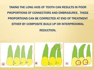TAKING THE LONG AXIS OF TOOTH CAN RESULTS IN POOR
PROPORTIONS OF CONNECTORS AND EMBRASURES . THESE
PROPORTIONS CAN BE CORRECTED AT END OF TREATMENT
EITHER BY COMPOSITE BUILD UP OR INTERPROXIMAL
REDUCTION.
 