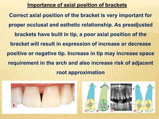 Importance of axial position of brackets
Correct axial position of the bracket is very important for
proper occlusal and esthetic relationship. As preadjusted
brackets have built in tip, a poor axial position of the
bracket will result in expression of increase or decrease
positive or negative tip. Increase in tip may increase space
requirement in the arch and also increase risk of adjacent
root approximation
 