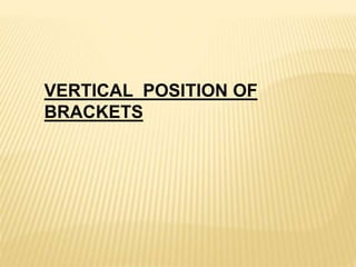 VERTICAL POSITION OF
BRACKETS
 