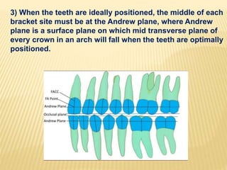 3) When the teeth are ideally positioned, the middle of each
bracket site must be at the Andrew plane, where Andrew
plane is a surface plane on which mid transverse plane of
every crown in an arch will fall when the teeth are optimally
positioned.
 