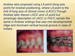 Andrew also proposed using LA point (long axis
point) for bracket positioning, where LA point is the
mid of long axis of clinical crown (LACC).Though
Andrew later disown LACC and LA point but
amazingly description of LACC or FACC remain the
same in Andrew writings that was mid developmental
ridge and dominant vertical buccal groove in case of
molars.
 
