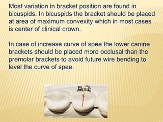 Most variation in bracket position are found in
bicuspids. In bicuspids the bracket should be placed
at area of maximum convexity which in most cases
is center of clinical crown.
In case of increase curve of spee the lower canine
brackets should be placed more occlusal than the
premolar brackets to avoid future wire bending to
level the curve of spee.
 
