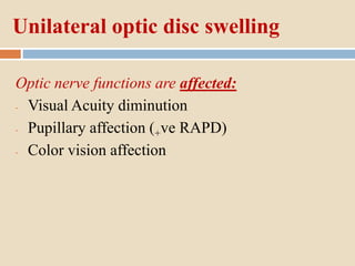 Unilateral optic disc swelling
Optic nerve functions are affected:
- Visual Acuity diminution
- Pupillary affection (+ve RAPD)
- Color vision affection
 