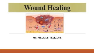 Wound Healing
MS.PRAGATI BAKANE
 