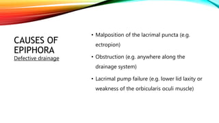 CAUSES OF
EPIPHORA
• Malposition of the lacrimal puncta (e.g.
ectropion)
• Obstruction (e.g. anywhere along the
drainage system)
• Lacrimal pump failure (e.g. lower lid laxity or
weakness of the orbicularis oculi muscle)
Defective drainage
 