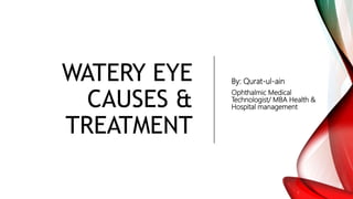 WATERY EYE
CAUSES &
TREATMENT
By: Qurat-ul-ain
Ophthalmic Medical
Technologist/ MBA Health &
Hospital management
 