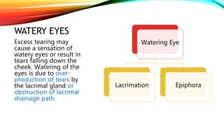 WATERY EYES
Watering Eye
Lacrimation Epiphora
Excess tearing may
cause a sensation of
watery eyes or result in
tears falling down the
cheek. Watering of the
eyes is due to over-
production of tears by
the lacrimal gland or
obstruction of lacrimal
drainage path.
 