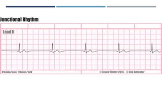 RHYTHM, RATE, AXIS.pptx