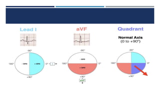 RHYTHM, RATE, AXIS.pptx