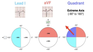 RHYTHM, RATE, AXIS.pptx