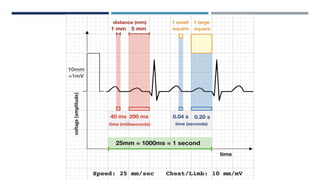 RHYTHM, RATE, AXIS.pptx