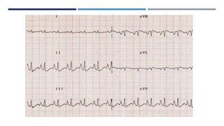 RHYTHM, RATE, AXIS.pptx