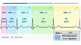 RHYTHM, RATE, AXIS.pptx