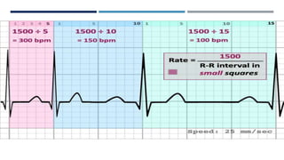 RHYTHM, RATE, AXIS.pptx