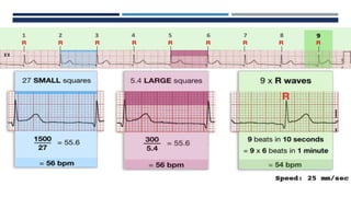 RHYTHM, RATE, AXIS.pptx