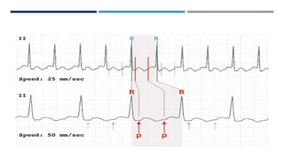 RHYTHM, RATE, AXIS.pptx