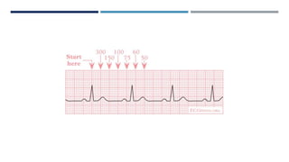RHYTHM, RATE, AXIS.pptx