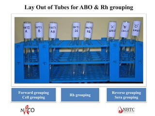 Forward grouping
Cell grouping
Rh grouping
Reverse grouping
Sera grouping
Lay Out of Tubes for ABO & Rh grouping
 