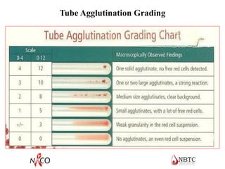 Tube Agglutination Grading
 