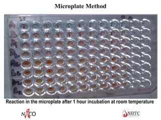 Reaction in the microplate after 1 hour incubation at room temperature
Microplate Method
 