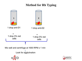 Method for Rh Typing
1 2
1 drop anti-D1 1 drop anti-D2
1 drop 5% red
cells
1 drop 5% red
cells
+ +
Mix well and centrifuge at 1000 RPM x 1 min
Look for agglutination
 