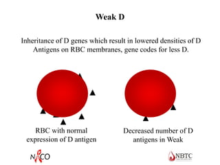 Weak D
RBC with normal
expression of D antigen
Decreased number of D
antigens in Weak
Inheritance of D genes which result in lowered densities of D
Antigens on RBC membranes, gene codes for less D.
 