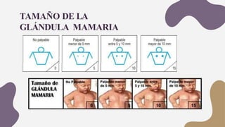 TAMAÑO DE LA
GLÁNDULA MAMARIA
 