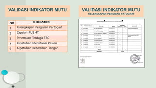 VALIDASI INDIKATOR MUTU
KELENGKAPAN PENGISIAN PATOGRAF
VALIDASI INDIKATOR MUTU
No INDIKATOR
1 Kelengkapan Pengisian Partograf
2 Capaian PUS 4T
3 Penemuan Terduga TBC
4 Kepatuhan Identifikasi Pasien
5 Kepatuhan Kebersihan Tangan
 