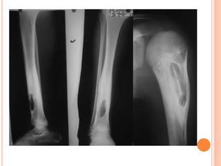 bones Radiological evaluation .pdf