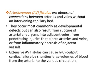 Arteriovenous (AV) fistulas are abnormal
connections between arteries and veins without
an intervening capillary bed.
• They occur most commonly as developmental
defects but can also result from rupture of
arterial aneurysms into adjacent veins, from
penetrating injuries that pierce arteries and veins,
or from inflammatory necrosis of adjacent
vessels.
• Extensive AV fistulas can cause high-output
cardiac failure by shunting large volumes of blood
from the arterial to the venous circulation.
 